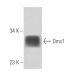 Dmc1 Antibody (5B10/2) - Western Blotting - Image 15826