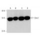 This polyclonal antibody has been discontinued. See our recommended <a href="dmc1-antibody-a-6">Dmc1 (A-6)</a> monoclonal antibody (sample data shown). western blotting image from recommended Dmc1 (A-6) monoclonal antibody replacement. Image 356354