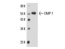 エイル＠DMP Quaife QDF7L ATB Helical Differential LSD R200 - Nissan