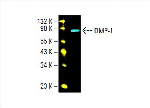 エイル＠DMP Quaife QDF7L ATB Helical Differential LSD R200 - Nissan