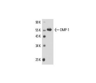 DMP-1 Antibody (LFMb-31) - Western Blotting - Image 17378The Double Nickase Plasmid features a U6 promoter for sgRNA expression, a 20 nt targeting sequence, and a gRNA scaffold to guide Cas9n. It includes a CBh promoter for Cas9n (D10A) and puromycin resistance, GFP for transfection verification, and nuclear localization signals (NLS). The 2A peptide allows co-expression of Cas9n and Puro from a single promoter, enabling precise genome editing with reduced off-target effects. 