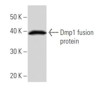 western blotting image from recommended Dmp1 (DMTF5I250) monoclonal antibody replacement. Image 16633
