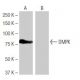 DMPK Antibody (9-RY26) - Western Blotting - Image 64915