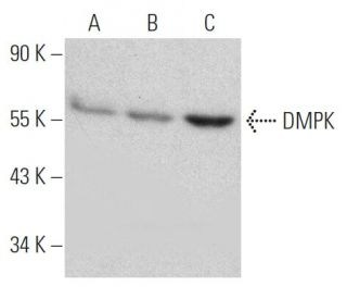 DMPK Antibody (9-RY26) - Western Blotting - Image 368244 