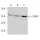 DMPK Antibody (9-RY26) - Western Blotting - Image 368244 