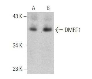 DMRT1 Antibody (A-9) - Western Blotting - Image 359455The Double Nickase Plasmid features a U6 promoter for sgRNA expression, a 20 nt targeting sequence, and a gRNA scaffold to guide Cas9n. It includes a CBh promoter for Cas9n (D10A) and puromycin resistance, GFP for transfection verification, and nuclear localization signals (NLS). The 2A peptide allows co-expression of Cas9n and Puro from a single promoter, enabling precise genome editing with reduced off-target effects.