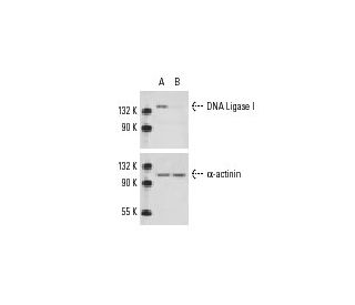 DNA Ligase I siRNA (m): sc-35199. Western blot analysis of DNA Ligase I expression in non-transfected control (A) and DNA 