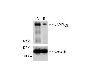 DNA-PK<sub>CS</sub> siRNA (h): sc-35200. Western blot analysis of DNA-PK<sub>CS</sub> expression in non-transfected contro 
