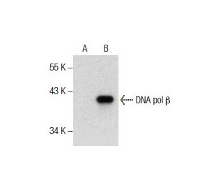 DNA pol &beta; Antibody (D-11) - Western Blotting - Image 157470SAM Transcription Activation: SAM system utilizing dCas9-VP64, MS2-P65-HSF1, and sgRNA for precise gene transcription activation. 