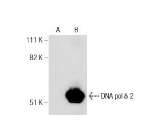DNA pol &delta; 2 Antibody (2762C3a) - Western Blotting - Image 160428 