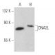 DNA2L Antibody (A-3) - Western Blotting - Image 366055