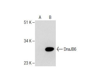 DnaJB6 Antibody (RQ-6) - Western Blotting - Image 282654