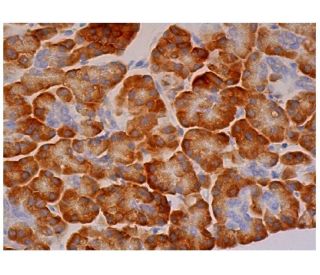 DnaJC3 Antibody (A-7) - Immunohistochemistry - Image 334009 