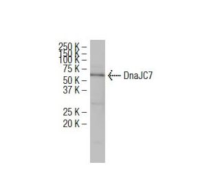 DnaJC7 Antibody (82SS) - Western Blotting - Image 34090 