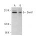 Dnmt1 Antibody (D-9) - Western Blotting - Image 376204 
