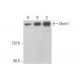This polyclonal antibody has been discontinued. See our recommended <a href="dnmt1-antibody-h-12">Dnmt1 (H-12)</a> monoclonal antibody (sample data shown). western blotting image from recommended Dnmt1 (H-12) monoclonal antibody replacement. Image 353162