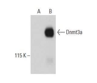 Dnmt3a Antibody (64B1446) - Western Blotting - Image 36390 