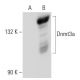 Dnmt3a Antibody (64B814) - Western Blotting - Image 42615
