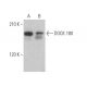 DOCK 180 Antibody (E-2) - Western Blotting - Image 372527 