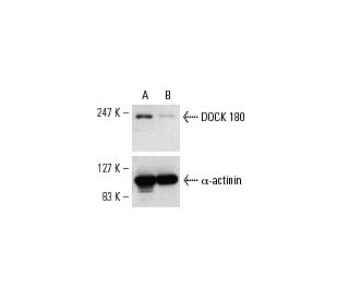 DOCK 180 siRNA (h): sc-35207. Western blot analysis of DOCK 180 expression in non-transfected control (A) and DOCK 180 siR 