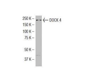 DOCK 4 Antibody (R6Y) - Western Blotting - Image 34091 