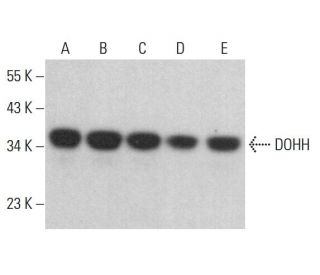 DOHH Antibody (E-2) - Western Blotting - Image 383096 