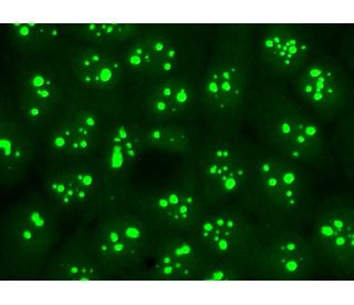 Nucleostemin (C-14): sc-46212. Immunofluorescence staining of formalin-fixed A-431 cells showing nucleolar and nuclear loc 