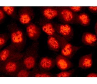 MRE11 (C-16): sc-5859. Immunofluorescence staining of formalin-fixed A-431 cells showing nuclear localization. Detection r