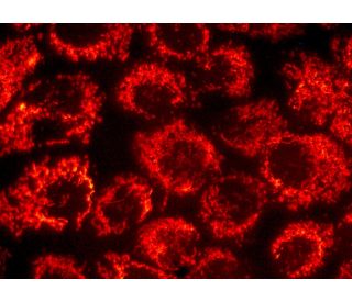 HSP 60 (K-19): sc-1722. Immunofluorescence staining of formalin-fixed A-431 cells showing mitochondrial localization. Dete 