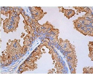 Cytokeratin 8 (C51): sc-8020. Immunoperoxidase staining of formalin fixed, paraffin-embedded human prostate tissue showing