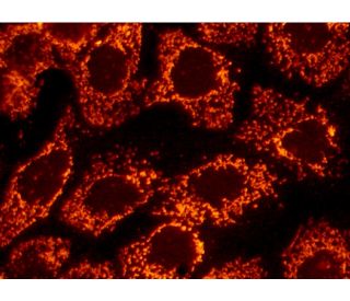 LRP130 (M-300): sc-66845. Immunofluorescence staining of formalin-fixed A-431 cells showing mitochondrial localization. De 
