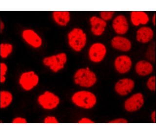 アブラ様 ヨシムラ ZX-14R/ABS US仕様 東南アジア仕様 Slip-On HEPTA