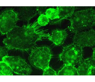 TDE2L (E-18): sc-138678. Immunofluorescence staining of formalin-fixed A-431 cells showing membrane localization. Detectio