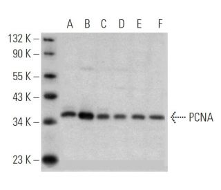 PCNA (FL-261): sc-7907. Western blot analysis of PCNA expression in A-431 (A), MOLT-4 (B), HeLa (C), Hep G2 (D), NIH/3T3 ( 