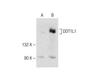 DOT1L1 Antibody (E-5) - Western Blotting - Image 149974