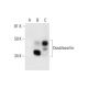 Doublecortin/DCX Antibody (E-5) - Western Blotting - Image 289678