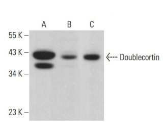 Doublecortin/DCX Antibody (E-5) - Western Blotting - Image 379655 