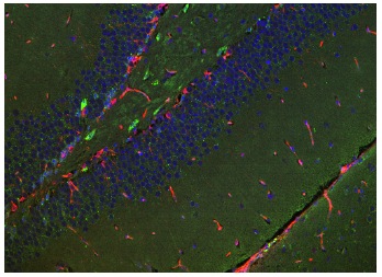 sakさま専用 Doublecortin/DCX Antibody (E-6) | SCBT - Santa Cruz Biotechnology