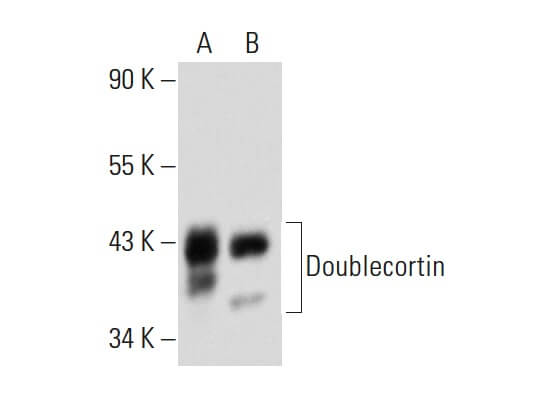 doublecortin-antibody-e-6-