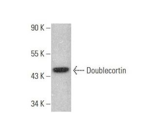 Doublecortin/DCX Antibody (E-6) | SCBT - Santa Cruz Biotechnology