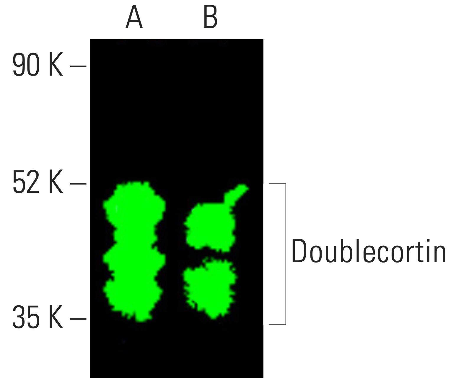 Doublecortin/DCX抗体(E-6) | SCBT - Santa Cruz Biotechnology