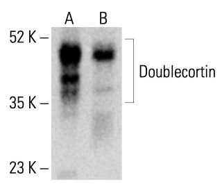 Doublecortin/DCX Antibody (E-6) | SCBT - Santa Cruz Biotechnology