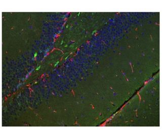 immunofluorescence image from recommended Doublecortin/DCX (E-6) monoclonal antibody replacement. Image 157373