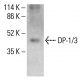 DP-1/3 Antibody (L7-7) - Western Blotting - Image 412767
