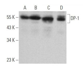 DP-1 Antibody (3F149) - Western Blotting - Image 364223 