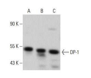 western blotting image from recommended DP-1 (TFD-10) monoclonal antibody replacement. Image 376117