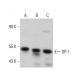 This polyclonal antibody has been discontinued. See our recommended <a href="dp-1-antibody-tfd-10">DP-1 (TFD-10)</a> monoclonal antibody (sample data shown). western blotting image from recommended DP-1 (TFD-10) monoclonal antibody replacement. Image 376117