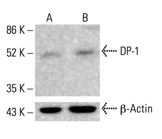 Q10様 ANTI-FAM164A(C-TERMINAL) antibody produced in rabbit