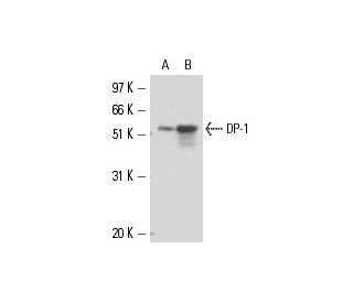 DP-1 Antibody (TFD-11) - Western Blotting - Image 16210 