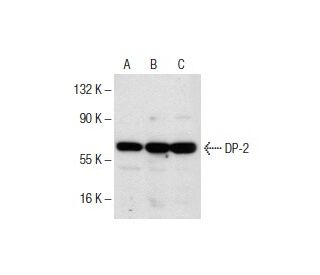 DP-2 Antibody (D-11) - Western Blotting - Image 153672 